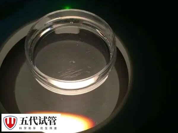 腹腔镜下取卵LOR是一种微创手术