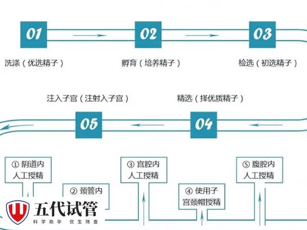 人工授精排卵周期方案有哪些